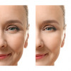 Ser antirid, Lifting Serum, Life Care®